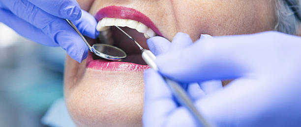 Best Knocked-Out Tooth Emergency  in East Quincy, CA